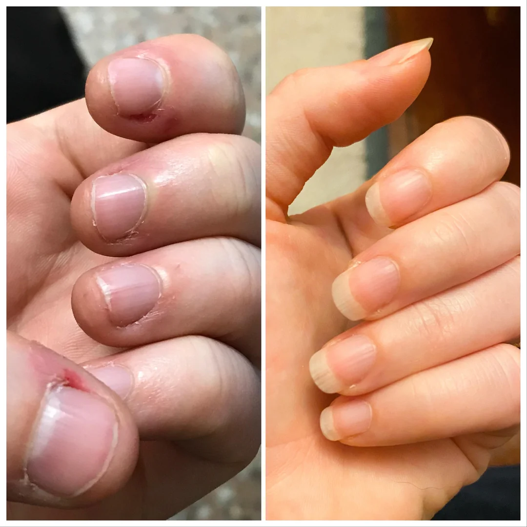 নখের সমস্যা