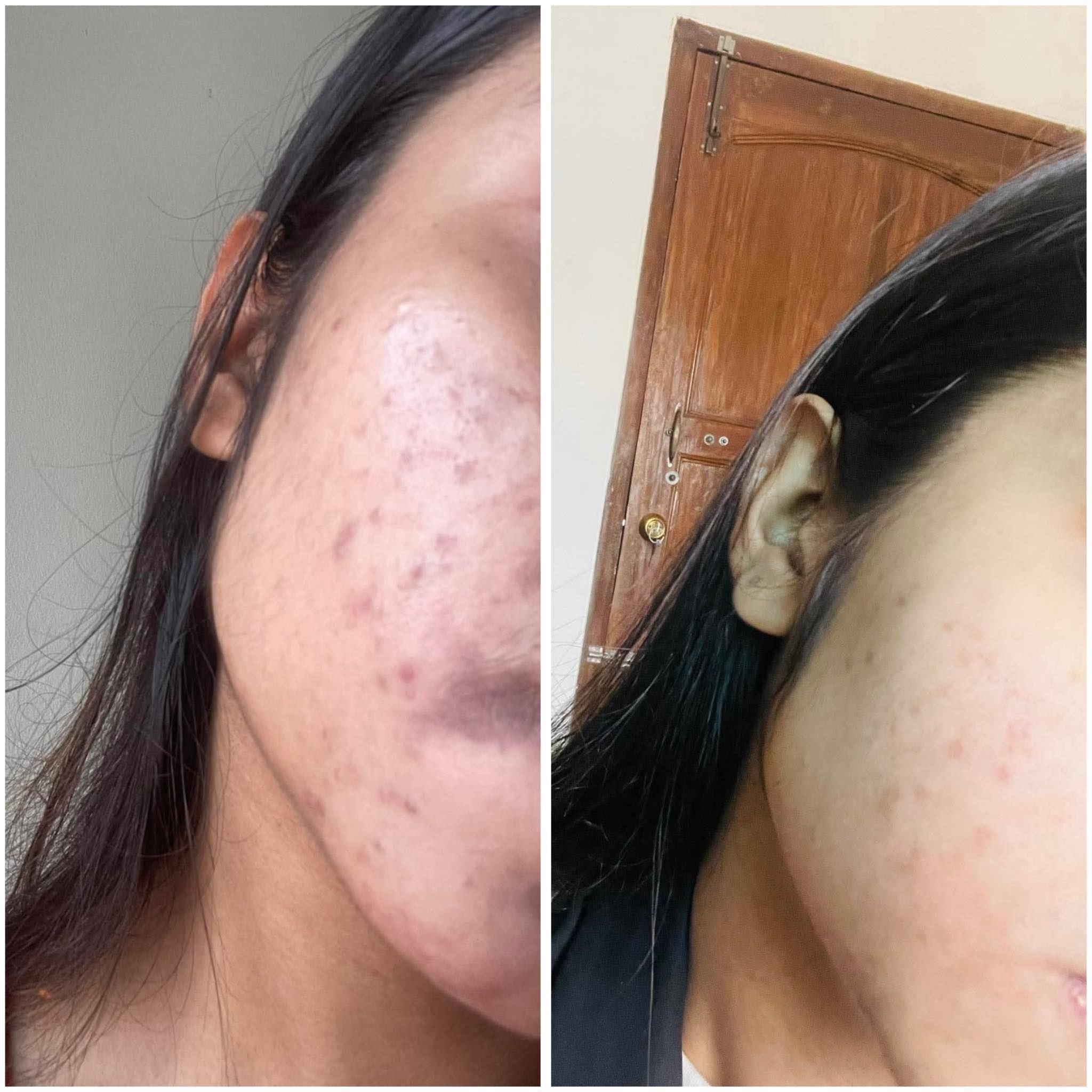 ত্বকের সমস্যা