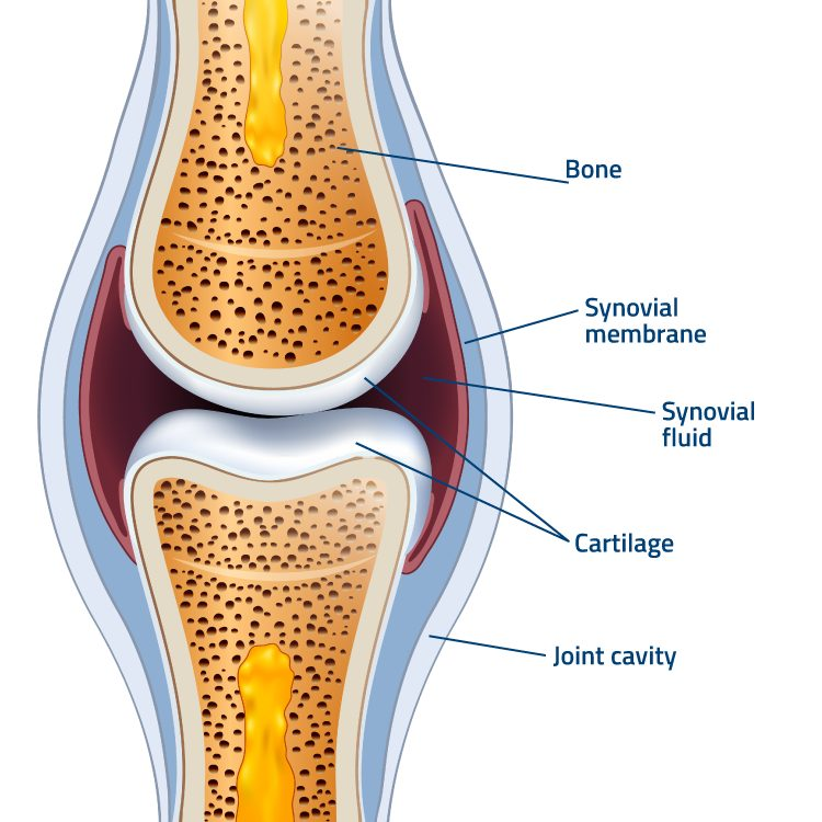 হাড়ের সমস্যা